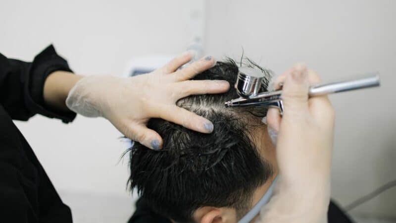 טיפול לייזר לנשירת שיער